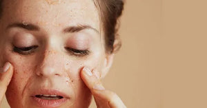 How To Repair Damaged Skin Barrier In Pakistan
