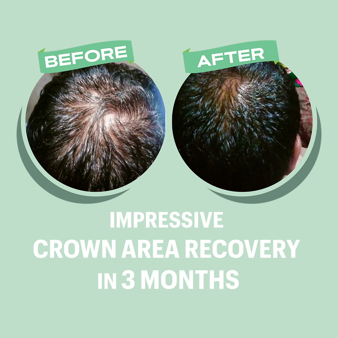 Nutrax Lab Croda Procapil® Anti Hair Loss and Hair Growth Serum